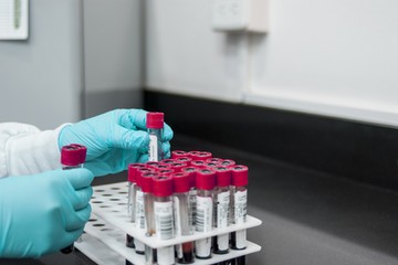 éves vérvizsgálat, diagnosztika, kis rutin, nagy rutin