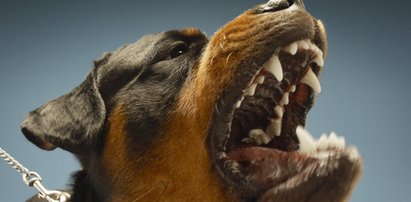 Rottweiler pogryzł dziecko! Chłopiec w ciężkim stanie!