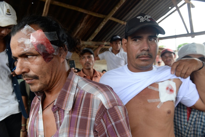 demonstranti povređeni u sukobima