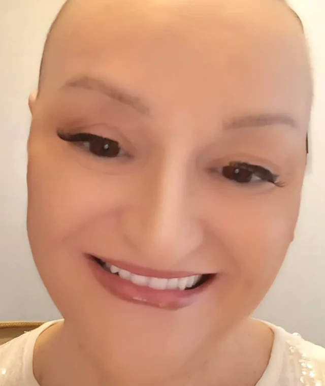 "Kancer se sam uselio, ali ja ga teram!" Milica Dugalić POKAZALA SNAGU UZ OSMEH i BEZ KOSE: "Nadam se da ću da pobedim" (FOTO)