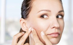 Z kuchni prosto na twarz: 5 domowych sposobów na trądzik