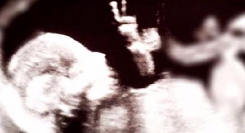 Baby in the womb gives peace sign in ultrasound photo