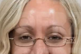 Otišla kod čuvenog PLASTIČARA u Turskoj i ljudi se hvataju za glavu zbog naredne slike: "Izgledate kao PROSEK, ja vas pretvaram u LEPOTICE", a onda se saznala istina