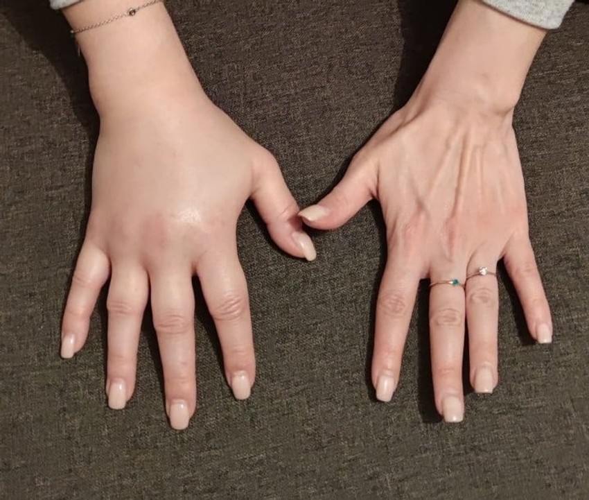 Jovanine ruke prilikom oticanja