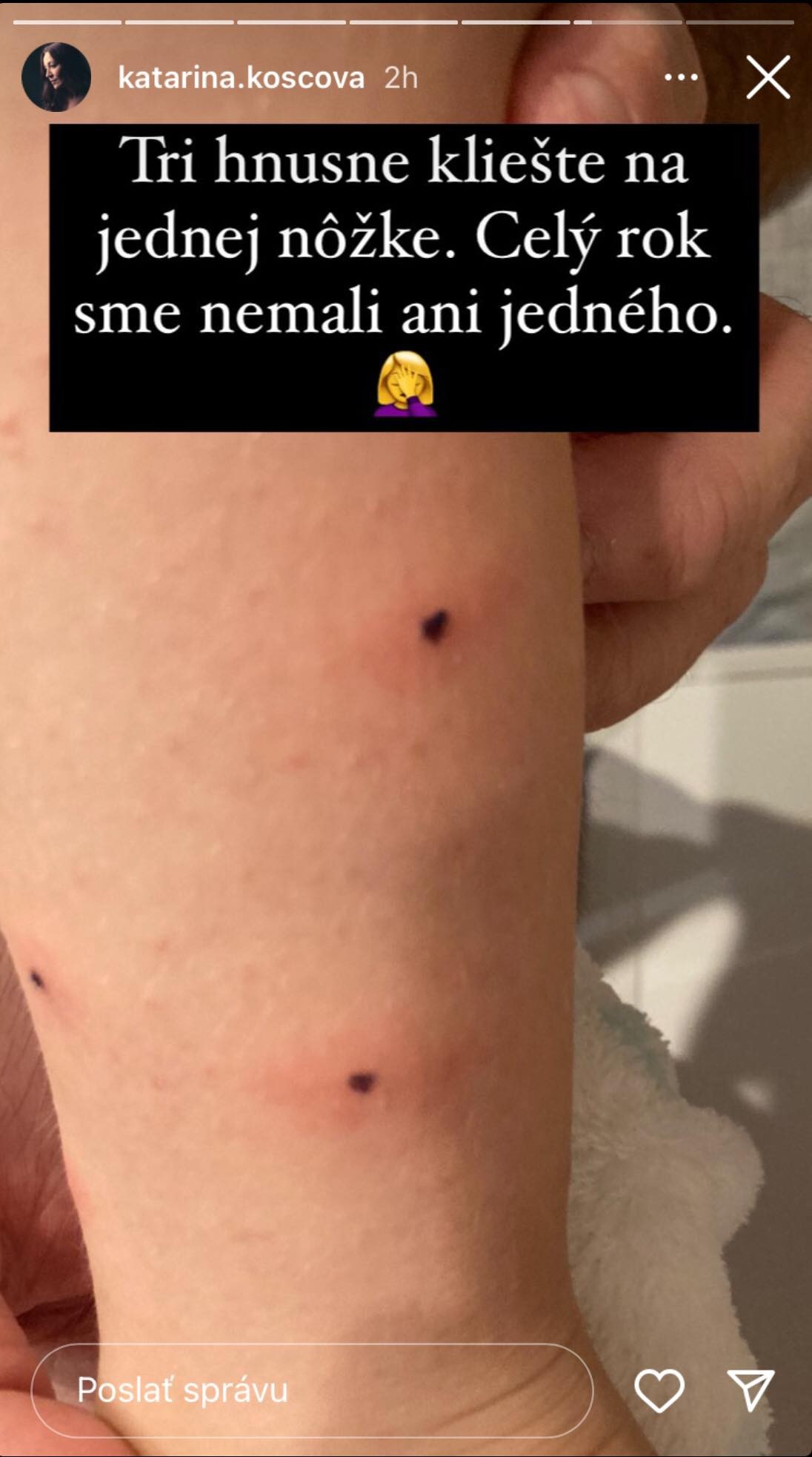 Katka zverejnila fotku na Instagrame.