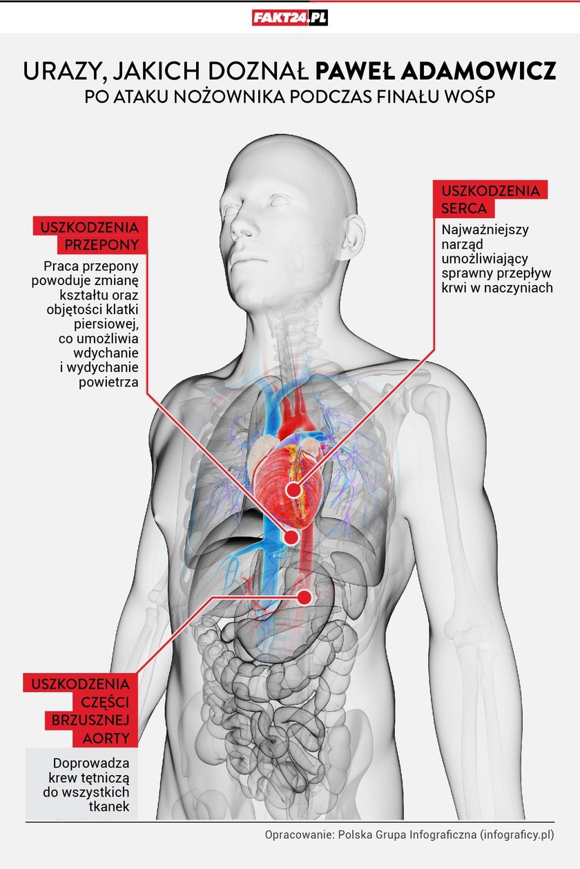 Tak lekarze walczyli o życie Pawła Adamowicza