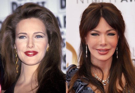 Hunter Tylo w 1993 r. i obecnie