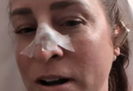 Amanda Anderson má rakovinu kože. 