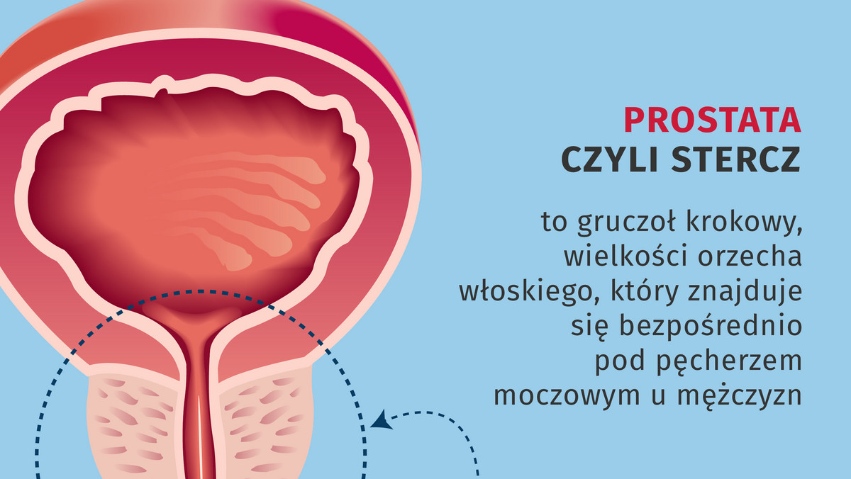 15 września to Europejski Dzień Prostaty, narządu znajdującego się u mężczyzn tuż pod pęcherzem moczowym. Problemy z prostatą pojawiają się najczęściej po 50. roku życia, a nowotwór tego narządu jest u mężczyzn drugim co do częstości. Co musisz wiedzieć o prostacie, a boisz się zapytać?