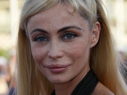 Gwiazda fracuskiego kina: zostałam okaleczona przez chirurgię plastyczną