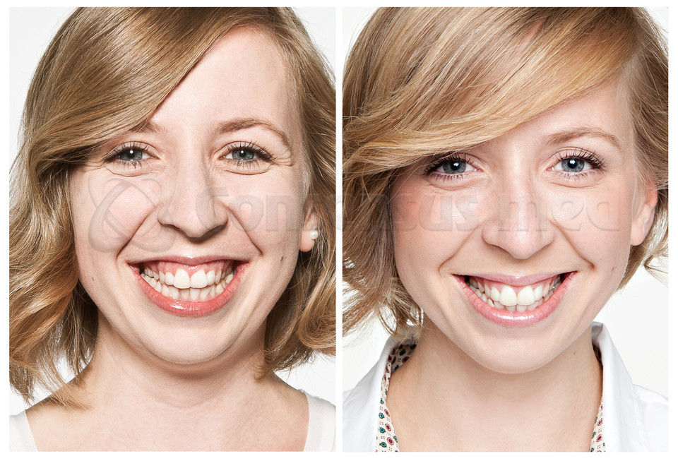 Katarzyna - zdjęcia przed i po