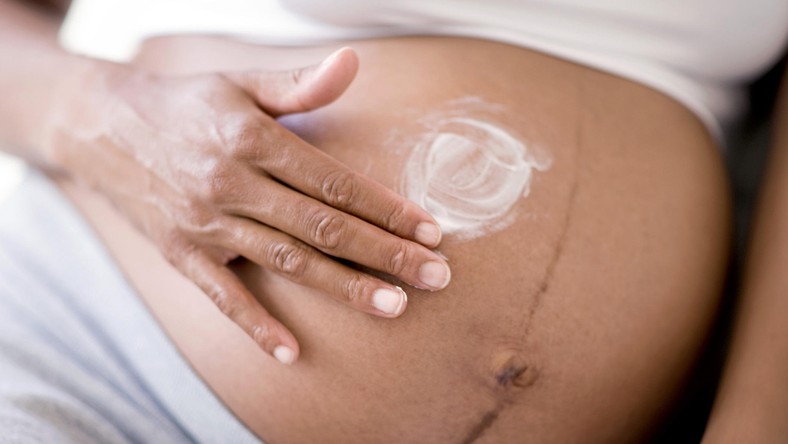 Here's how to eliminate pregnancy stretch marks [The Bump]