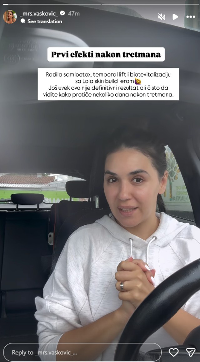 Aleksandra Vasković otkrila šta je sve radila na sebi