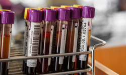 Czy grupa krwi wpływa na ryzyko zakażenia koronawirusem? [WYJAŚNIAMY]