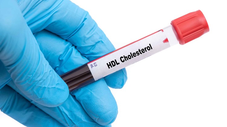 Mit jelent HDL-koleszterin érték laborlelet