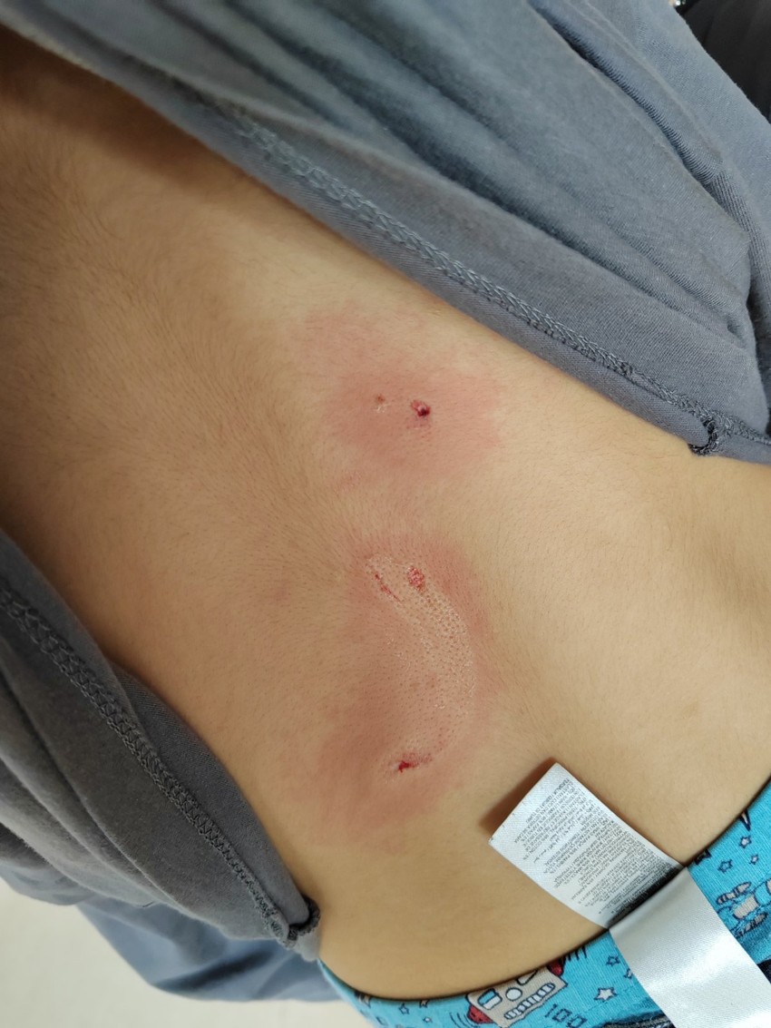 Povrede na dečaku od 29. marta