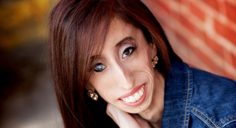 Once dubbed the 'world's ugliest woman,' Lizzie Velazquez shuts down viral memes shaming her