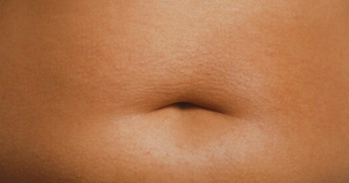 Belly Fat: 5 natural remedies to help you get rid of it