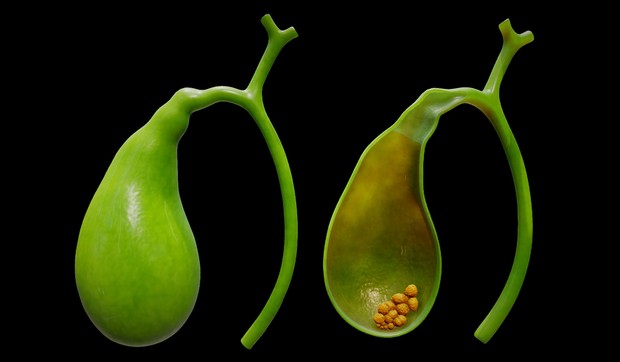 Žučna kesa je mali organ u obliku kruške 