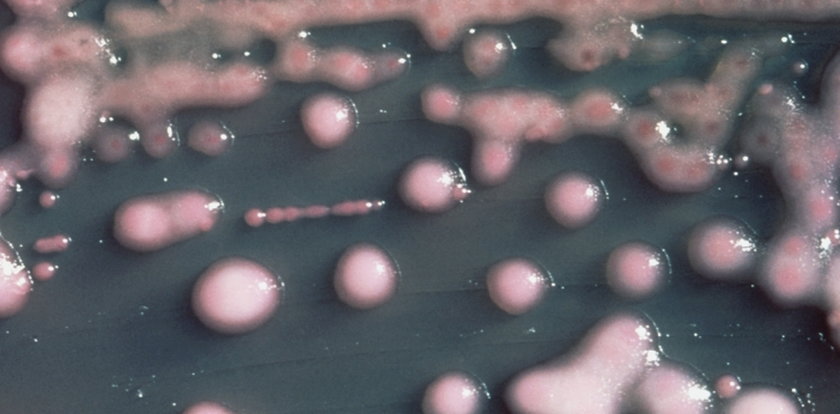 Epidemiolodzy walczą z superbakterią