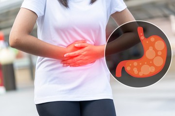 reflux gyomorégés say ételek kerülése diéta