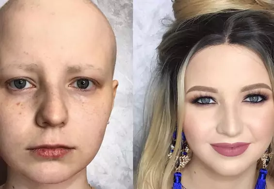 Zmagają się z rakiem, bliznami i trądzikiem - makijaż całkowicie je odmienia