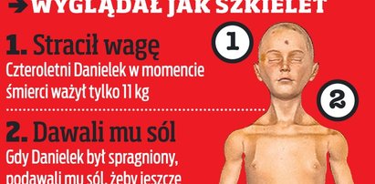 Danielek wyglądał jak szkielet!