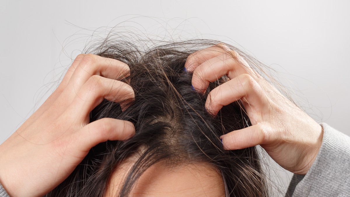 Kraste na temenu mogu biti posledica niza dermatoloških stanja