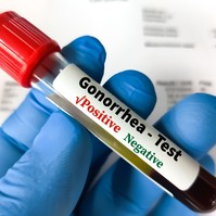 Engedélyezték a chlamydia és a gonorrhoea első otthoni tesztjét