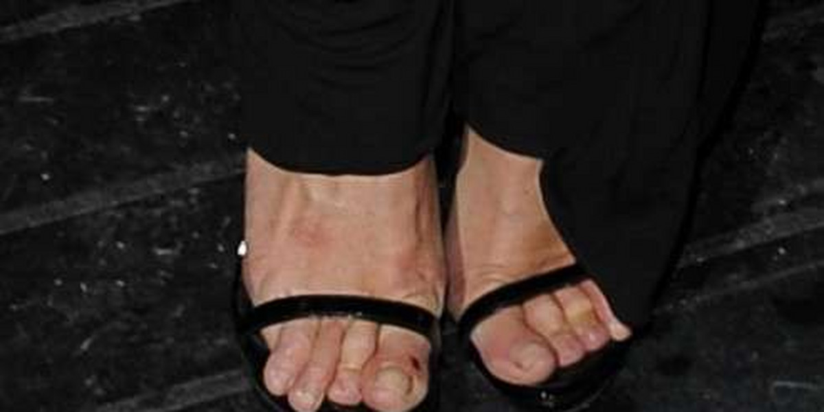 Straszne stopy Kate Moss