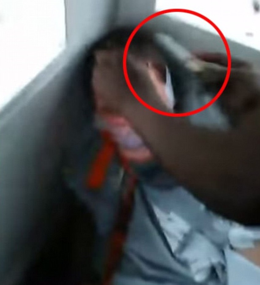 Sekli su mu kosu sve dok nije počeo da krvari