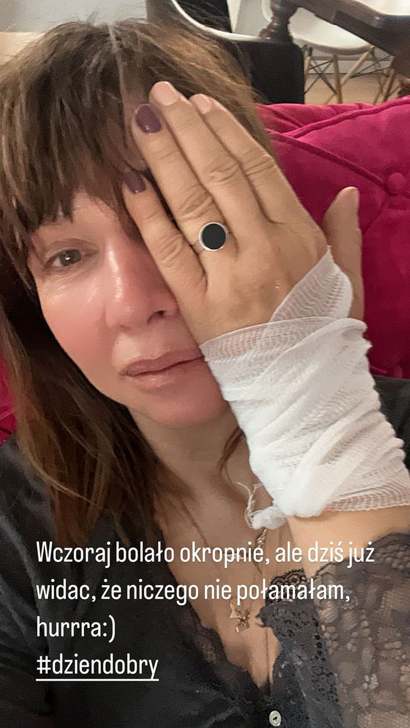 Grażyna Wolszczak pokazała uszkodzoną rękę.
