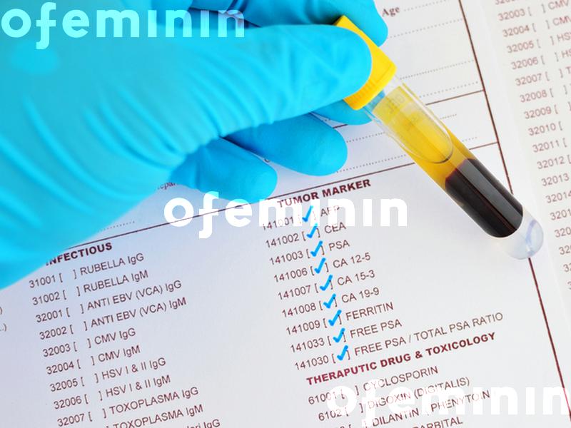 CEA - wskaźnik nowotworowy we krwi (normy, sposób badania) | Ofeminin