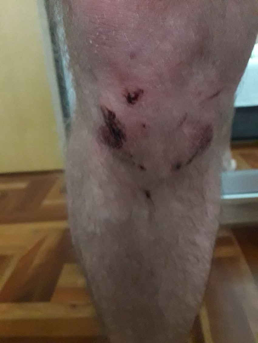 Dušan Nastić tvrdi da ga je pretukao policajac