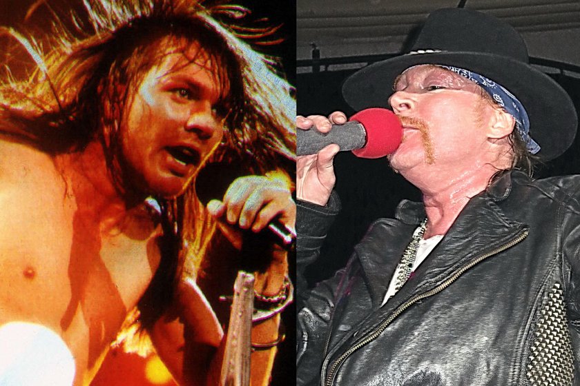 Axl Rose