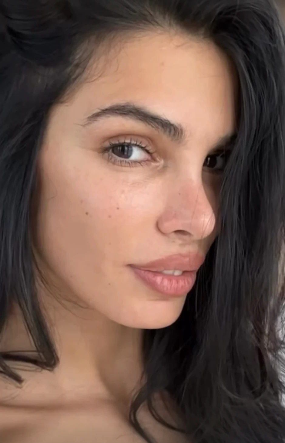 Jovana Đorđević nakon operacije usana