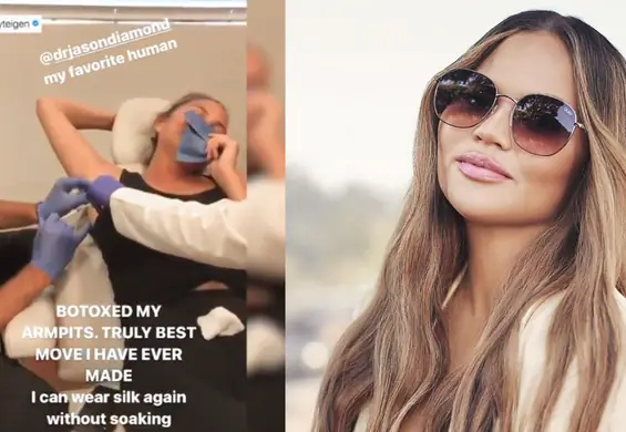 Chrissy Teigen wstrzyknęła sobie botoks, ale nie ma to nic wspólnego z odmładzaniem