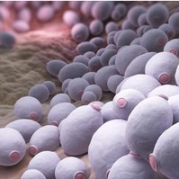 Candida-gomba: ezt írja fel ellene az orvos, ha nagyon elszaporodik
