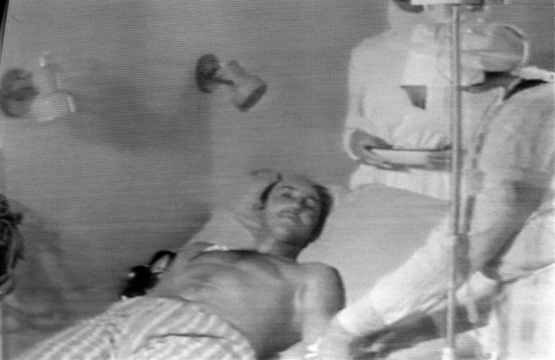 Mężczyzna ranny w wyniku wybuchu reaktora w elektrowni atomowej w Czarnobylu, 4 czerwca 1986 r.