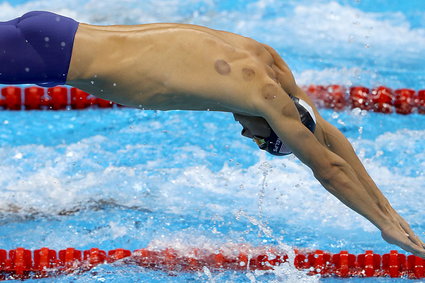 Dlaczego Michael Phelps i inni sportowcy mają czerwone kółka na skórze?