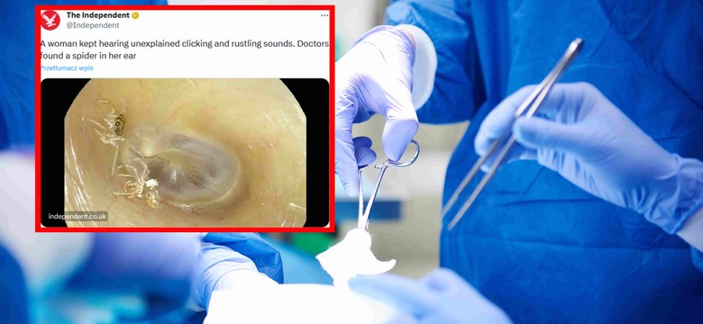 Kobieta słyszała dziwne dźwięki. Lekarze znaleźli w jej uchu coś okropnego