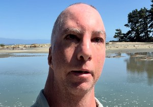 Danijel ima redak poremećaj, davali su mu 1 dan da preživi, a on napunio 41 godinu