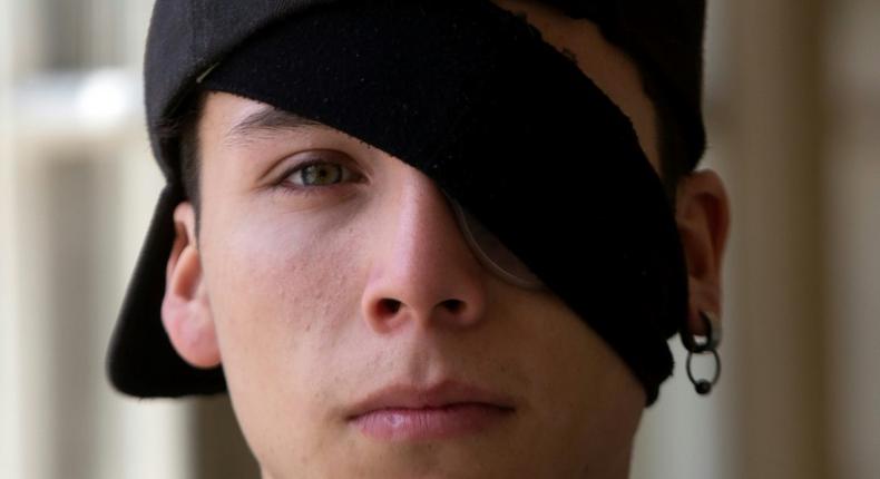 Student Carlos Vivanco lost the sight in his left eye during protests in Chile