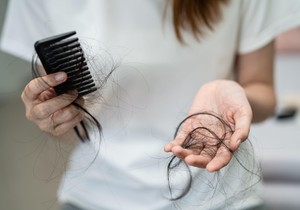 U najvećem broju slučajeva gubitak kose nakon porođaja prolazi sam od sebe, ali ovaj proces zahteva vreme