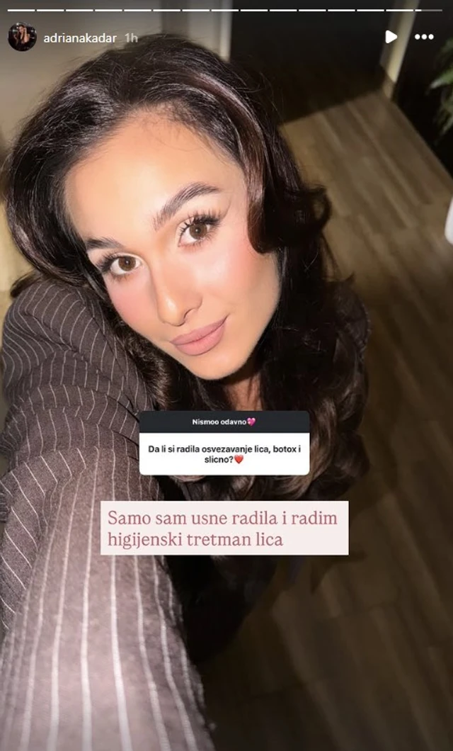 SNAJKA GORDANE DŽEHVEROVIĆ IPAK NIJE PRIRODNA: Evo šta je korigovala na sebi!