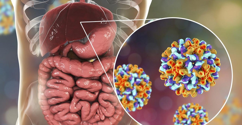 Wirus Zapalenia Wątroby Zmniejsza Ryzyko Przerzutów Raka Do Wątroby 6926