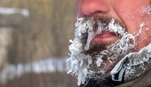 Hipotermija može da bude stanje opasno po život 