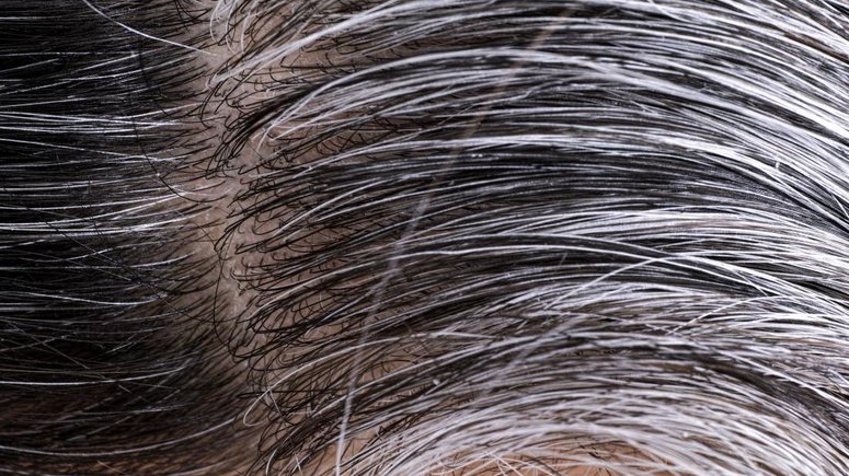 Premature Gray Hair How To Reverse This Condition Naturally