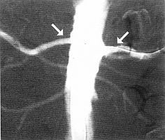 angiografia2-d00000E7A34e4ff260ff5
