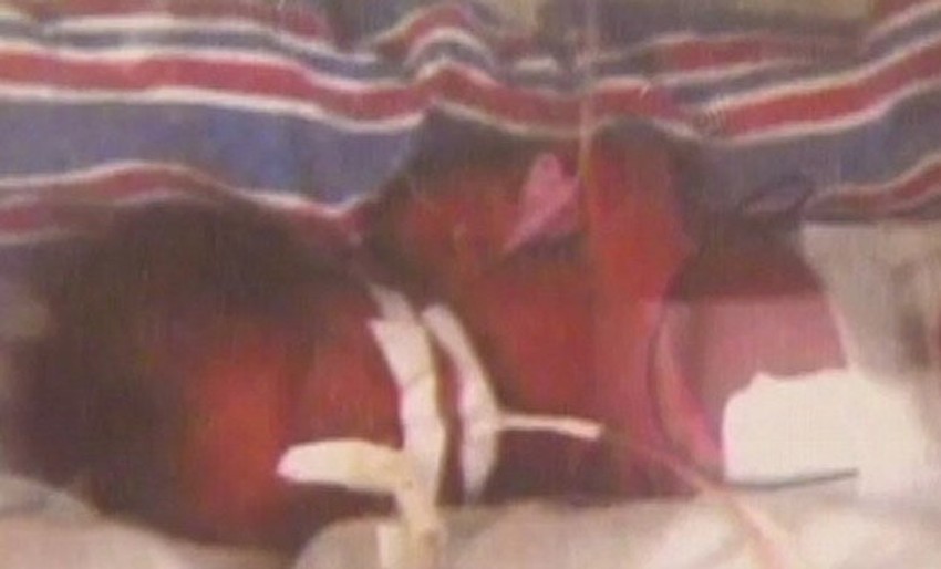 Bebe se još nalaze u inkubaturu, jer su rođene prevremeno, u 25 nedelji trudnoće, sa težinim od oko 600 grama